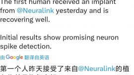 馬斯克宣布首例人類大腦芯片植入