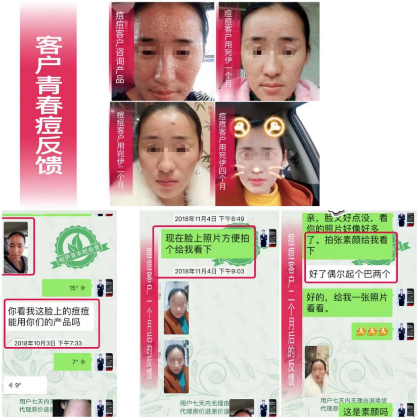 宛伊安琦莉效果好不好，网上卖的贵吗