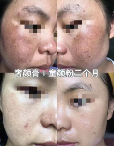 【揭秘】童颜家族代理需要囤货吗？门槛是多少钱？