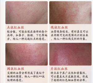 甜肤美科技大家都可以做吗，代理有什么要求