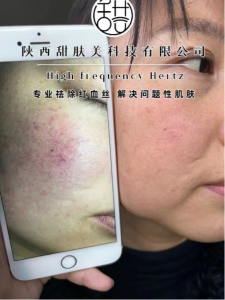 甜肤美科技大家都可以做吗，代理有什么要求