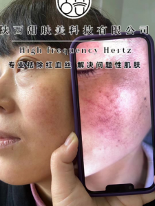 甜肤美科技大家都可以做吗，代理有什么要求