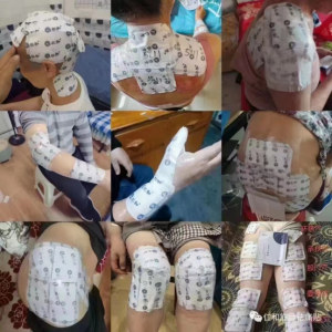 仁和筋骨祛痛贴代理有什么要求，购买找谁咨询