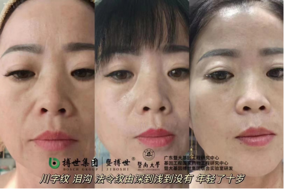 暨搏世涂抹式抗衰招加盟商是多少，代理可以挣钱吗-月光资讯网