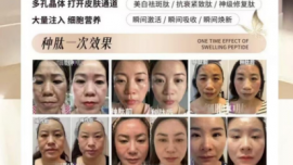 【2025-2026】：久龄之谜全国总代理艾米老师代理好做吗,市场前景怎么样【高品】