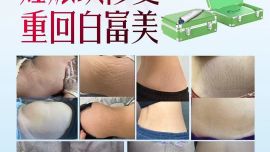 【2025-2026】：久龄之谜全国总代理艾米老师值得信赖吗，代理价格表是多少【招商】